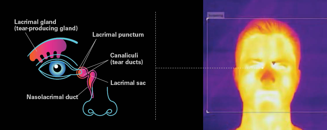 Body temperature readings of inner canthus and thermal screening of skin temperature
